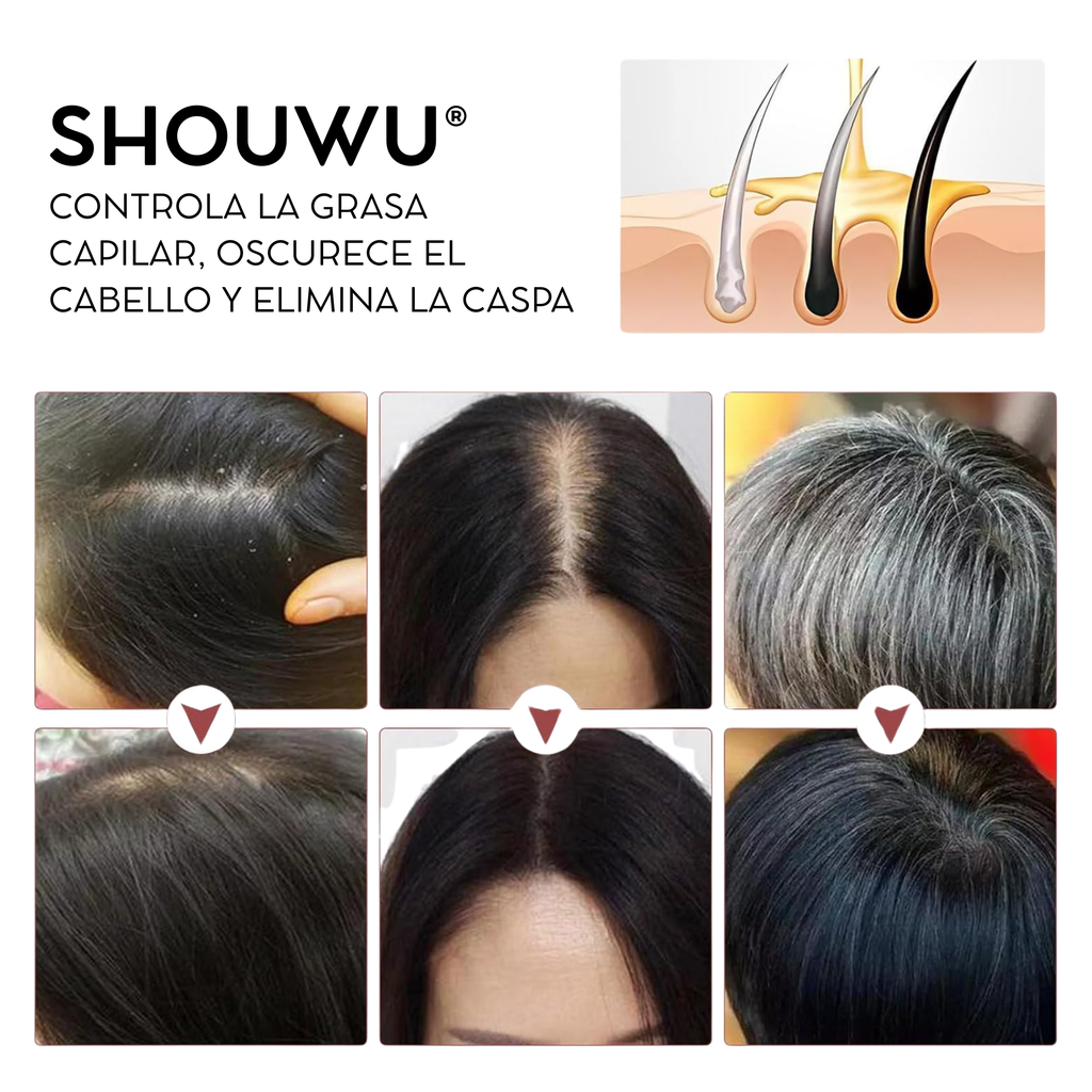 Shouwu® 3x1 - Jabón de polygonum para el cabello