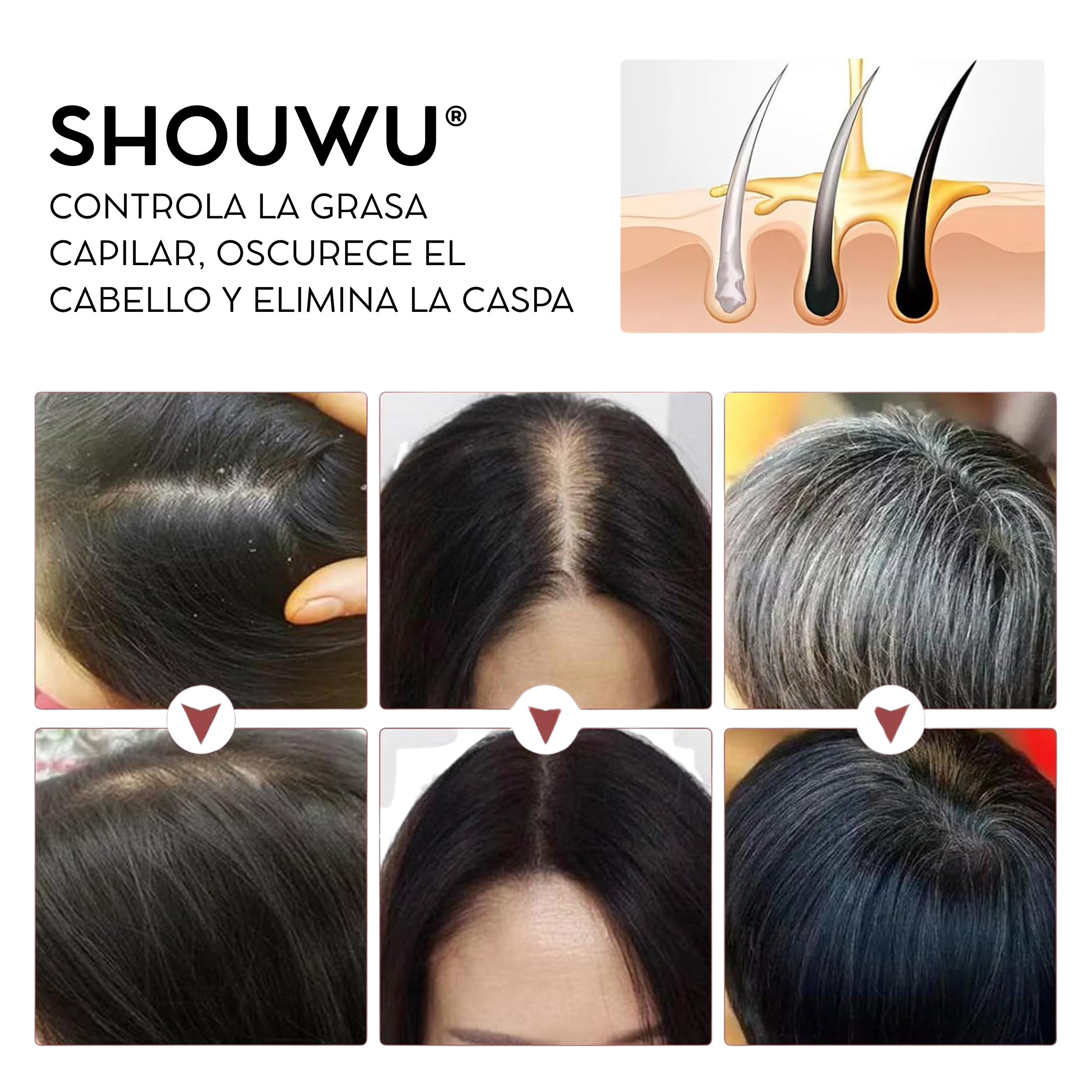 Shouwu® 3x1 - Jabón de polygonum para el cabello