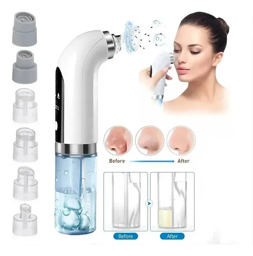 LuxeFace® Aqua - Extractor De Succión Con Agua