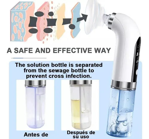 LuxeFace® Aqua - Extractor De Succión Con Agua