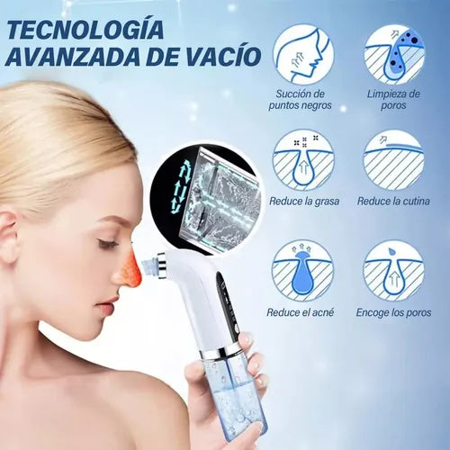LuxeFace® Aqua - Extractor De Succión Con Agua